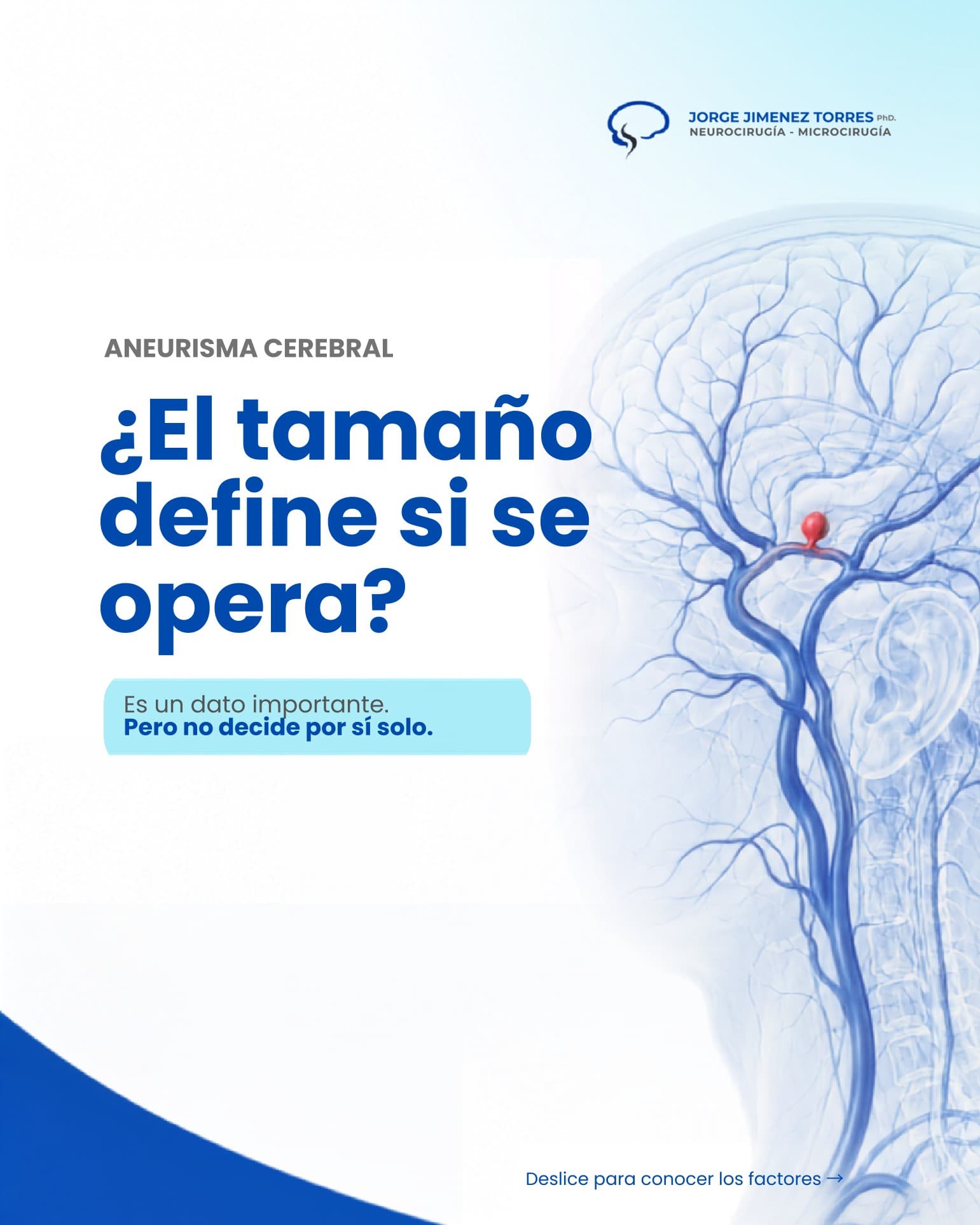 Aneurisma Cerebral - ¿El tamaño define si se opera?